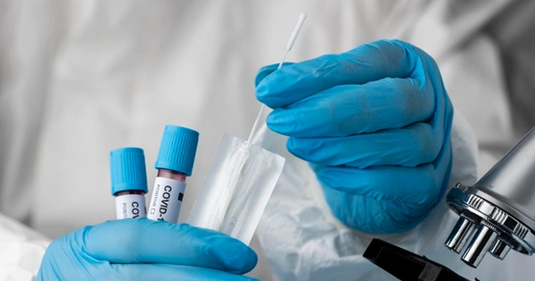 El PP moralo califica de “inocentada inaceptable” el nuevo protocolo para la realización de test PCR